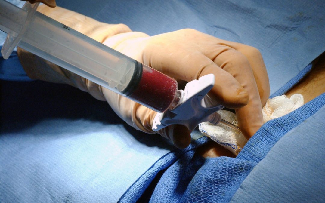 Transplante de medula: riscos que você não conhecia